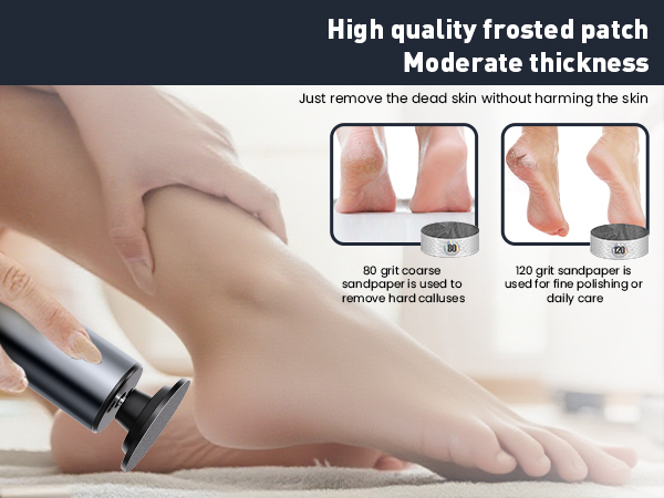 foot file callus remover