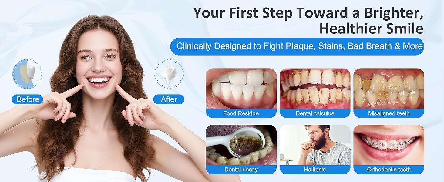 Water Dental Flosser for Teeth