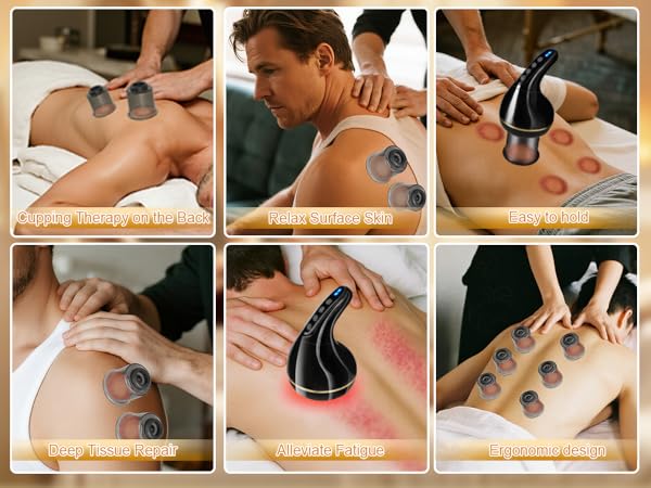 Electric Cupping Therapy Set