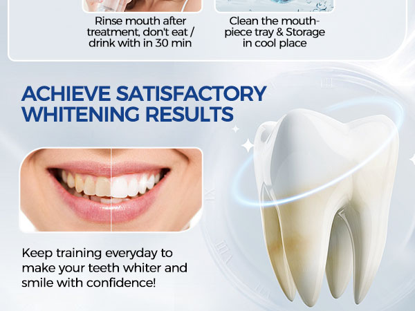 teeth whitening kit white sensitive light professional dental gel tooth whiten whitener whiting