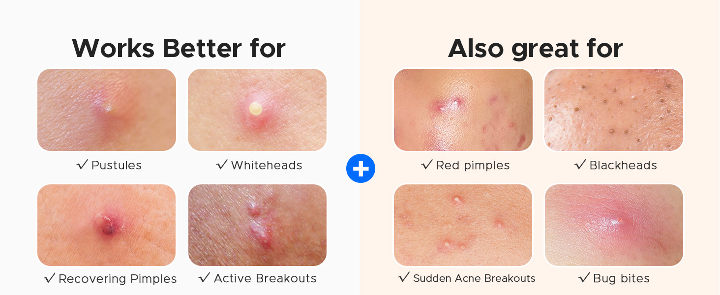 little bear pimple patches