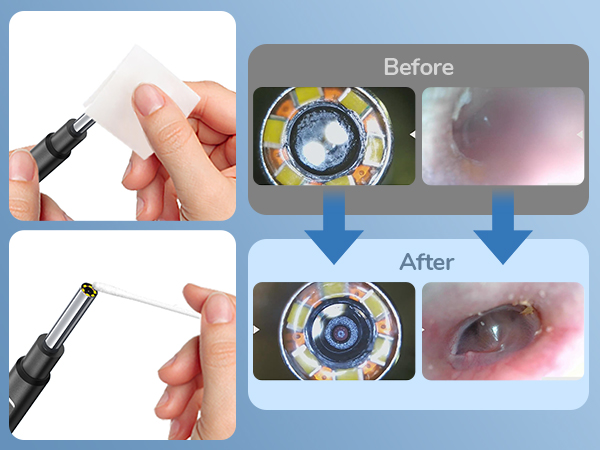 Cleaning for otoscope camera