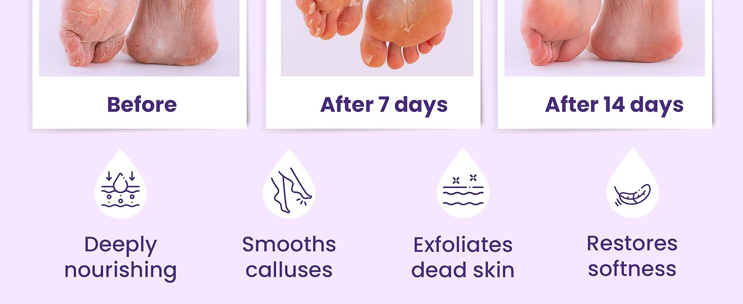 best foot peeling masks exfoliating foot mask exfoliating foot peel exfoliating foot peel mask exfol