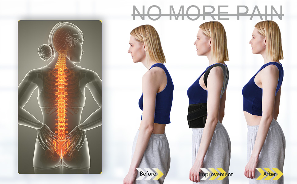 back brace for posture