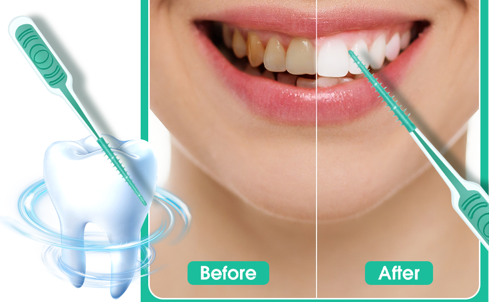 interdental brush