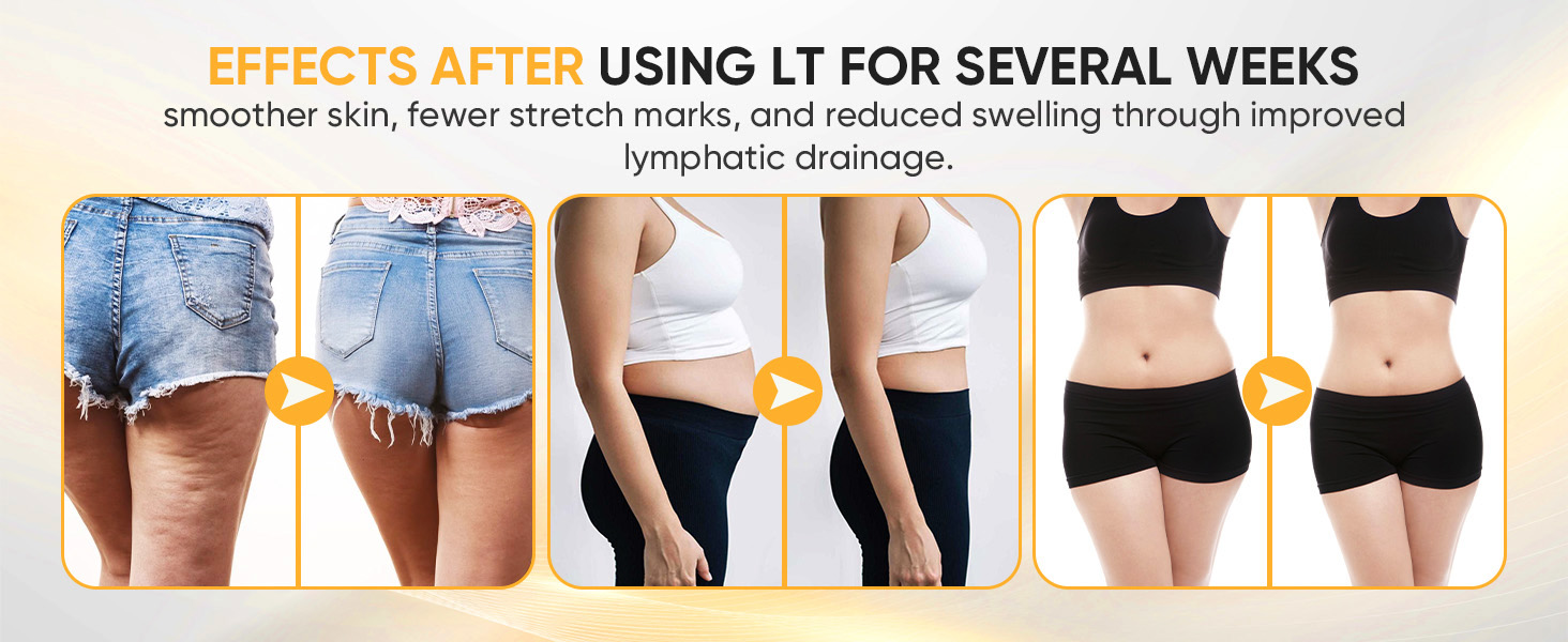 lymphatic drainage massager - Anti Cellulite Massage Tool &amp;amp; Body Sculpting Machine