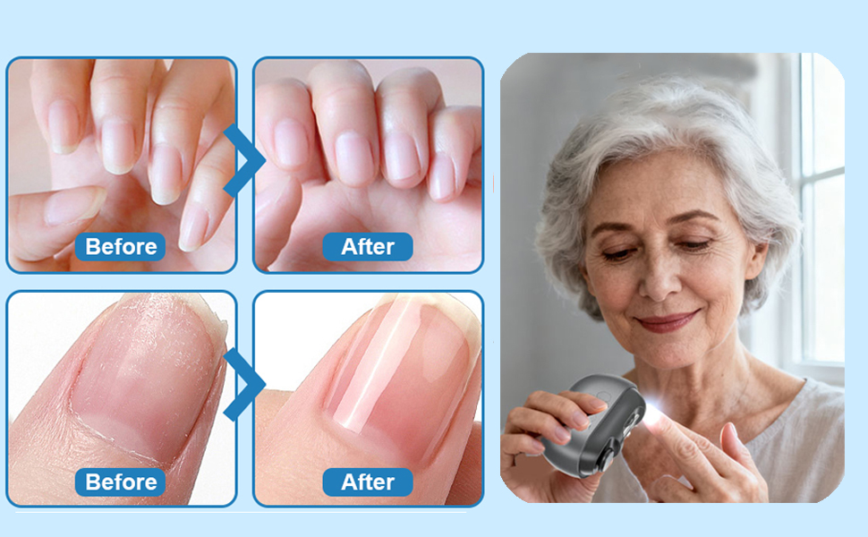 Electric Nail Clipper