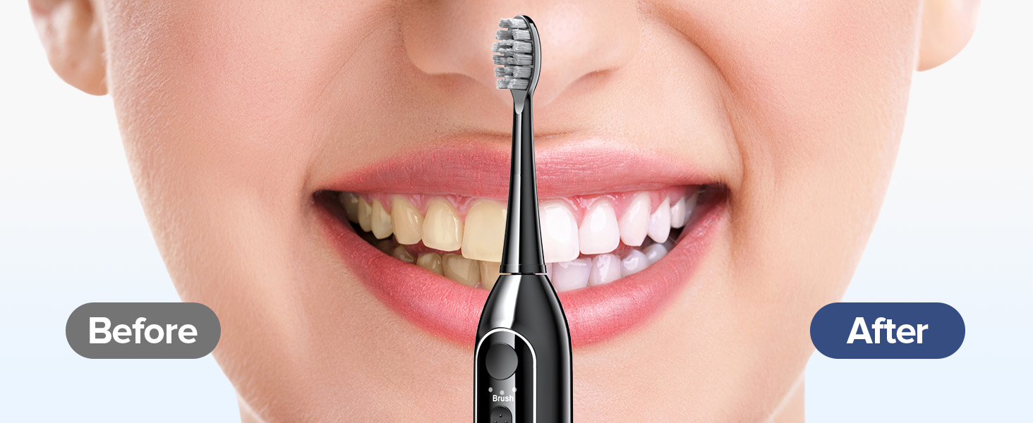 electric toothbrush with water flosser