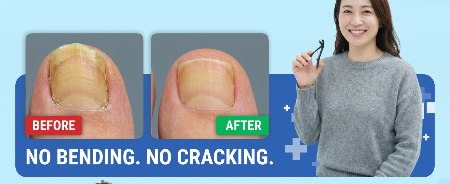 toe nail clippers