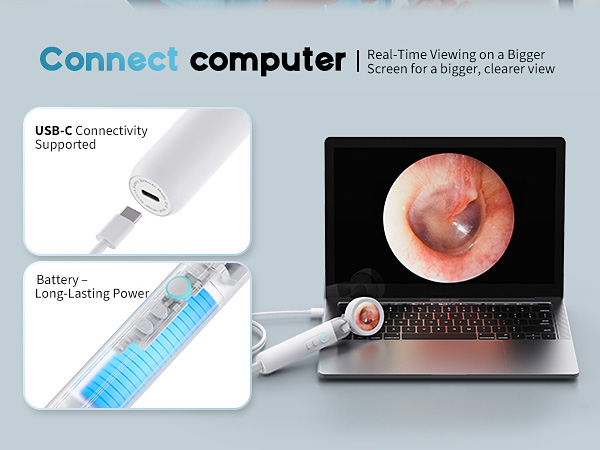 Otoscope