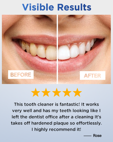 dental calculus remover