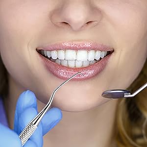 limpiador de dientes quita sarro